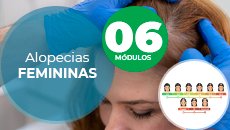Alopecias Femininas-capa-SITE