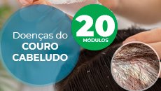 Doenças do couro cabeludocapa SITE