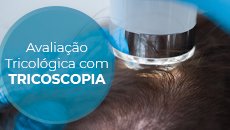 avaliação-tricologica-tricoscopia-capa SITE
