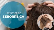 dermatite-seborreica-capa SITE