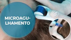 microagulhamento-capa SITE