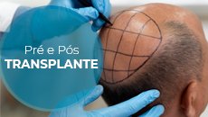 pre-transplante-capa SITE